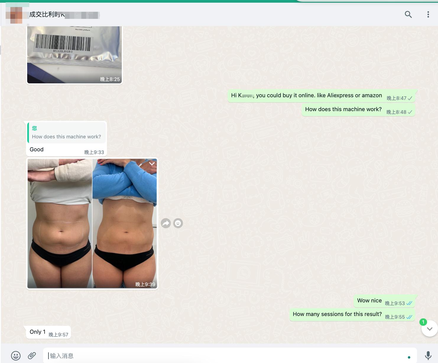 Visible Fat Reduction After Just 1 Session
