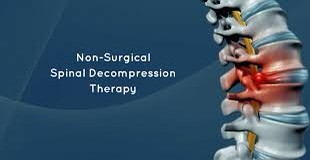 What Is Spinal Decompression Therapy?