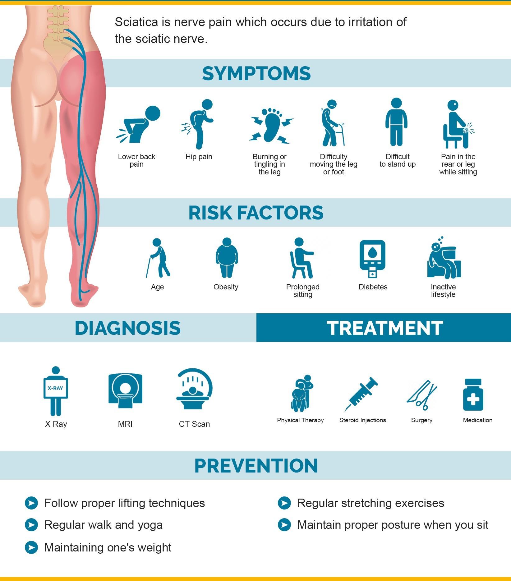 What You Need to Know About Sciatica Now