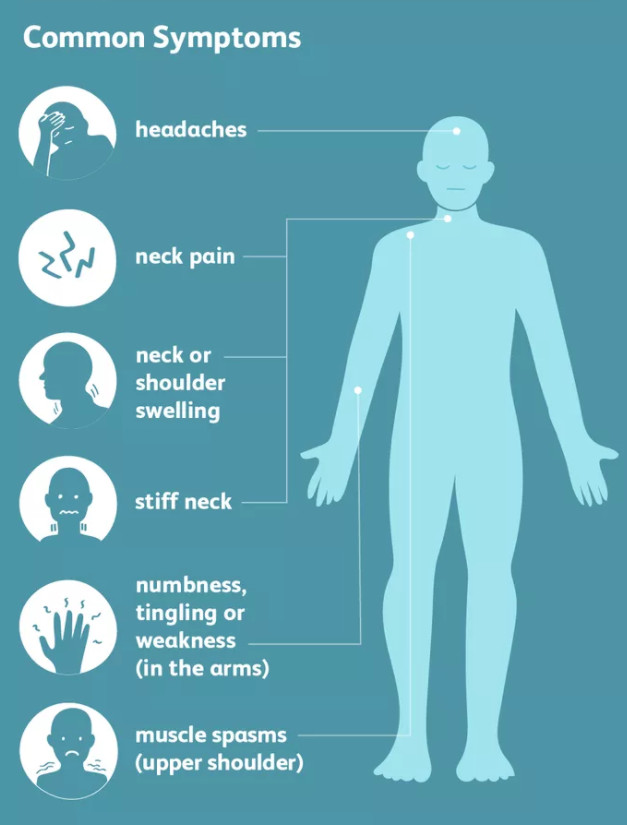 About Neck Pain